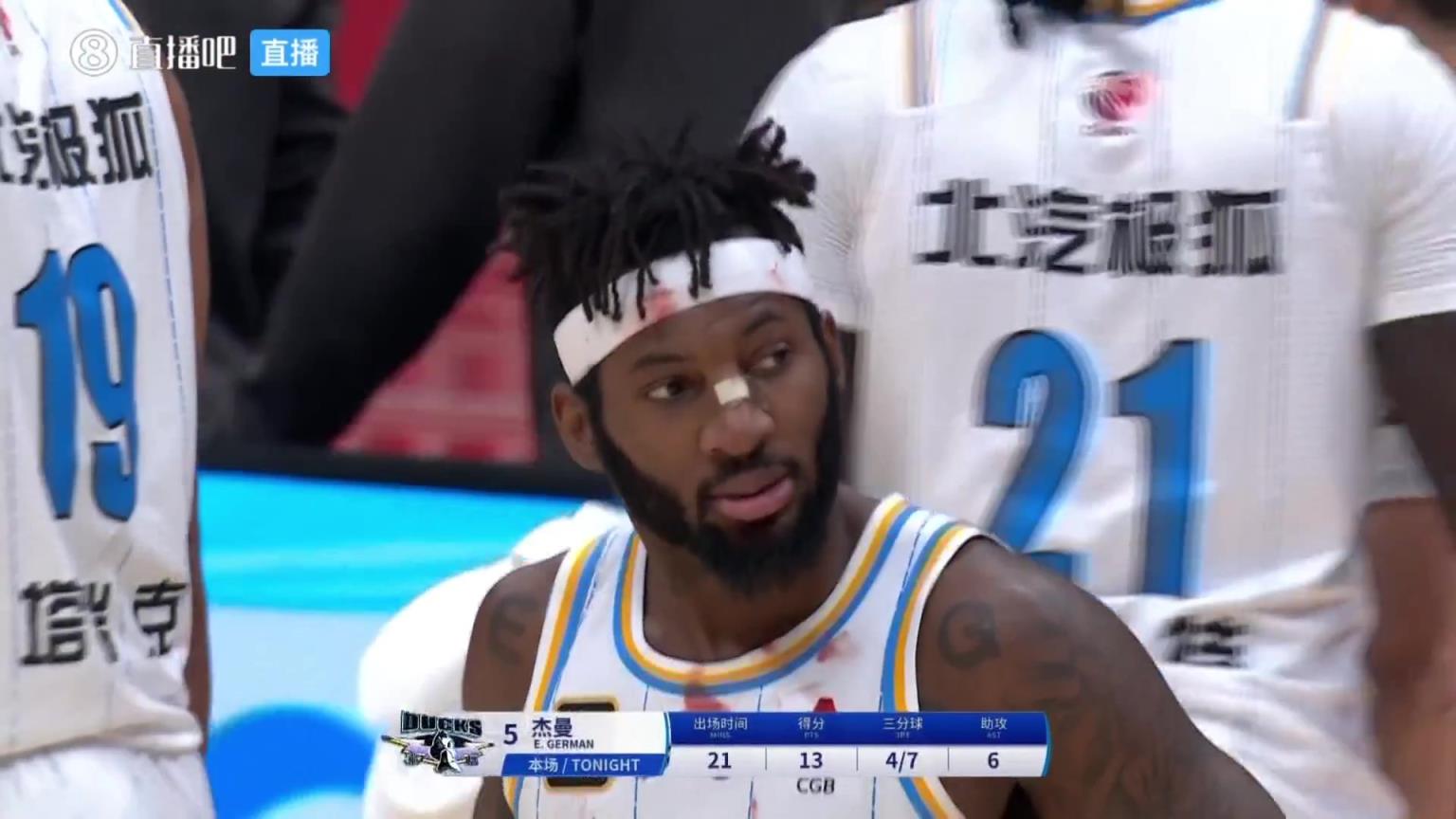 賺的都是血汗錢！杰曼被犯規流血后 戰袍和發帶都是血跡！